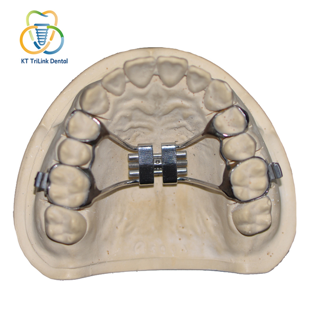 Rapid Palatal Expander（RPE）