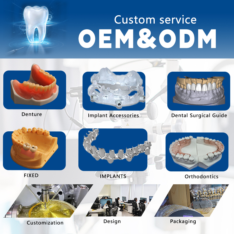 Implant Mono Scanbody เข้ากันได้กับ ACM ICX
