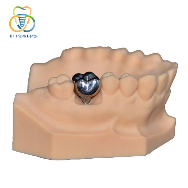 Имплант PFM Monobloc Crown (Co‑Cr)