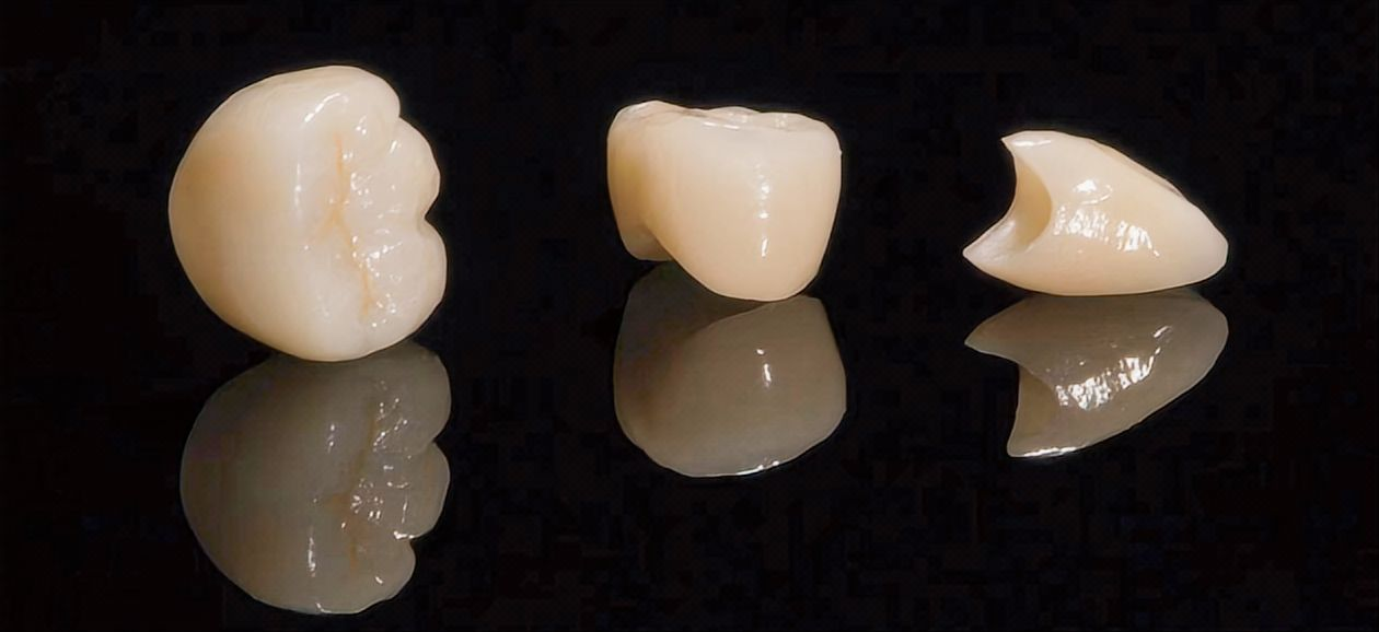 ເຮືອນຍອດເຊລາມິກ & Zirconia